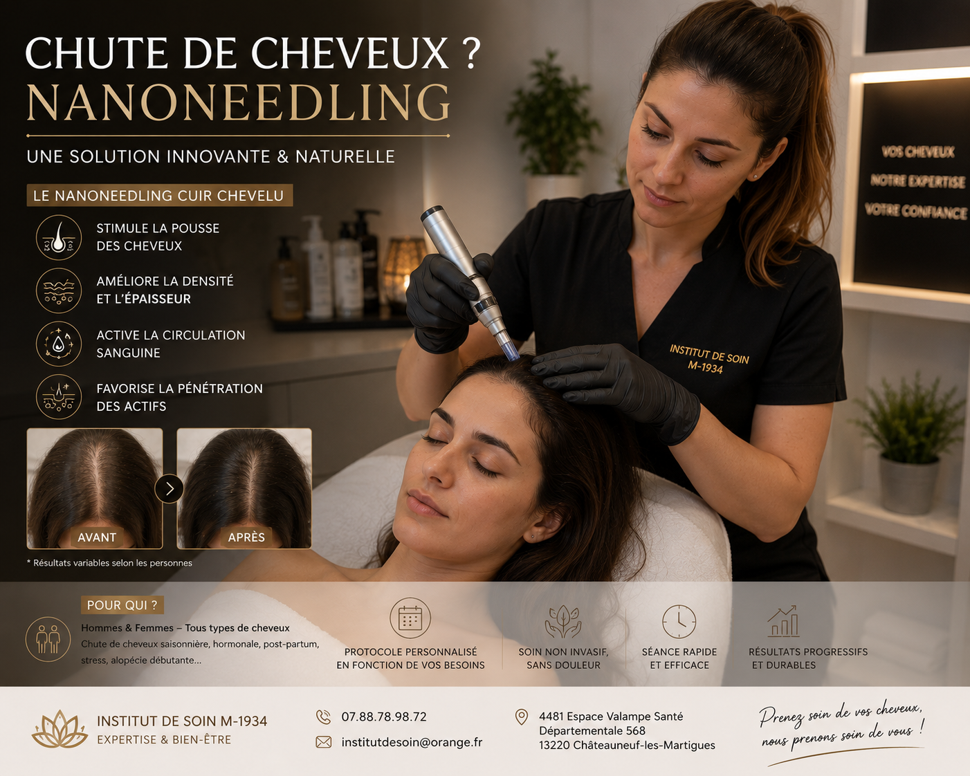 Nanoneedling cuir chevelu